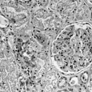 Fourier ptychographic imaging via scalable SDP